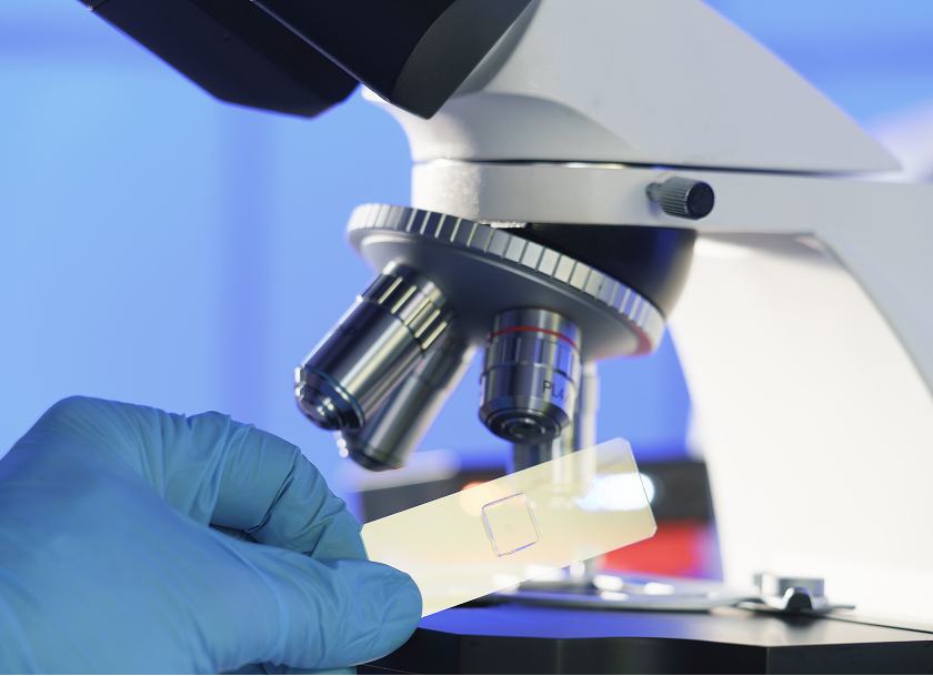 조직검사 · 용종제거