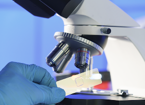 조직검사 · 용종제거